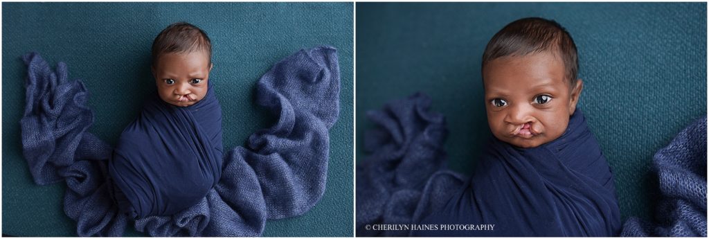 newborn baby boy with cleft palette photographed in baton rouge, louisiana by cherilyn haines